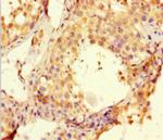 BTNL2 Antibody in Immunohistochemistry (Paraffin) (IHC (P))