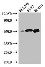 BTNL2 Antibody in Western Blot (WB)