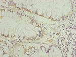 TRIM31 Antibody in Immunohistochemistry (Paraffin) (IHC (P))