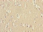 VPS33B Antibody in Immunohistochemistry (Paraffin) (IHC (P))