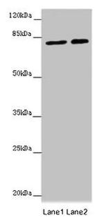 DHX33 Antibody in Western Blot (WB)