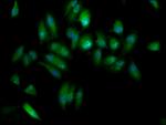 ELP3 Antibody in Immunocytochemistry (ICC/IF)