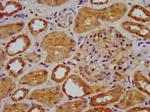 ELP3 Antibody in Immunohistochemistry (Paraffin) (IHC (P))