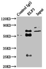 ELP3 Antibody in Western Blot (WB)