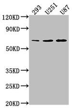 TCF7L1 Antibody in Western Blot (WB)