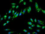 GTPBP4 Antibody in Immunocytochemistry (ICC/IF)