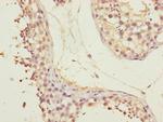 CEP72 Antibody in Immunohistochemistry (Paraffin) (IHC (P))