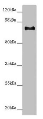 CEP72 Antibody in Western Blot (WB)