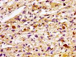 TBC1D14 Antibody in Immunohistochemistry (Paraffin) (IHC (P))