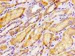 TBC1D14 Antibody in Immunohistochemistry (Paraffin) (IHC (P))