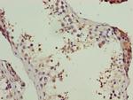 LSM7 Antibody in Immunohistochemistry (Paraffin) (IHC (P))