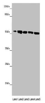 MINPP1 Antibody in Western Blot (WB)