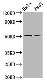 PLAGL2 Antibody in Western Blot (WB)