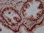 RALY Antibody in Immunohistochemistry (Paraffin) (IHC (P))