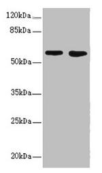 FLVCR2 Antibody in Western Blot (WB)