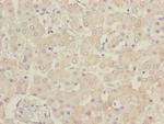 B9D1 Antibody in Immunohistochemistry (Paraffin) (IHC (P))