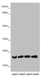 B9D1 Antibody in Western Blot (WB)