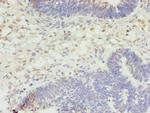 STK38L Antibody in Immunohistochemistry (Paraffin) (IHC (P))