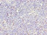 STK38L Antibody in Immunohistochemistry (Paraffin) (IHC (P))