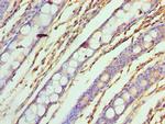 ASF1A Antibody in Immunohistochemistry (Paraffin) (IHC (P))