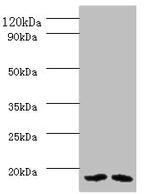 PAM16 Antibody in Western Blot (WB)