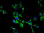 ROBO1 Antibody in Immunocytochemistry (ICC/IF)