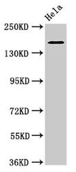 ROBO1 Antibody in Western Blot (WB)