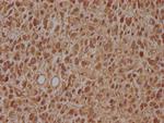 ARL2BP Antibody in Immunohistochemistry (Paraffin) (IHC (P))