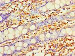 DHRS7 Antibody in Immunohistochemistry (Paraffin) (IHC (P))