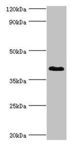 DHRS7 Antibody in Western Blot (WB)