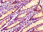 SSX2IP Antibody in Immunohistochemistry (Paraffin) (IHC (P))