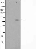 Phospho-HBP1 (Ser402) Antibody in Western Blot (WB)