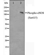 Phospho-eNOS (Ser615) Antibody in Western Blot (WB)