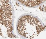 Phospho-FER (Tyr402) Antibody in Immunohistochemistry (Paraffin) (IHC (P))