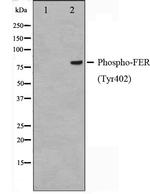 Phospho-FER (Tyr402) Antibody in Western Blot (WB)