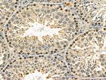 Phospho-FANCG (Ser383) Antibody in Immunohistochemistry (Paraffin) (IHC (P))