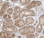 GAB2 Antibody in Immunohistochemistry (Paraffin) (IHC (P))