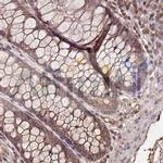 Collagen II Antibody in Immunohistochemistry (Paraffin) (IHC (P))