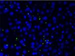 Collagen II Antibody in Immunohistochemistry (Paraffin) (IHC (P))