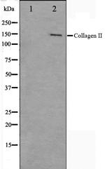 Collagen II Antibody in Western Blot (WB)