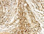 Cyclin A Antibody in Immunohistochemistry (Paraffin) (IHC (P))