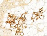 Cyclin A Antibody in Immunohistochemistry (Paraffin) (IHC (P))