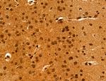 Cyclin A Antibody in Immunohistochemistry (Paraffin) (IHC (P))