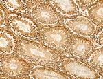 Cyclin A Antibody in Immunohistochemistry (Paraffin) (IHC (P))