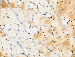 Cyclin A Antibody in Immunohistochemistry (Paraffin) (IHC (P))