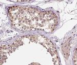 Cyclin A Antibody in Immunohistochemistry (Paraffin) (IHC (P))