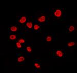 DP1 Antibody in Immunocytochemistry (ICC/IF)