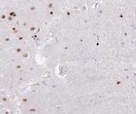 DP1 Antibody in Immunohistochemistry (Paraffin) (IHC (P))