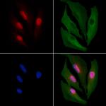 E2F4 Antibody in Immunocytochemistry (ICC/IF)