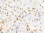 E2F4 Antibody in Immunohistochemistry (Paraffin) (IHC (P))